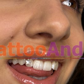 New! Gemas dentales