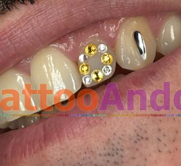 Corner joyas dentales 