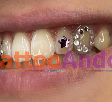 Eventos, fiestas, festivales joyas dentales 