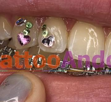 Joyitas dentales para eventos 