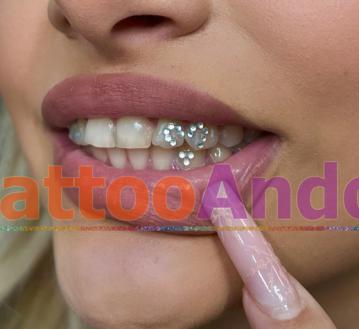 Implantación joyas dentales en eventos 