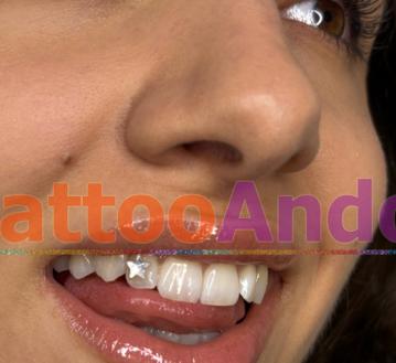Gemas dentales eventos 