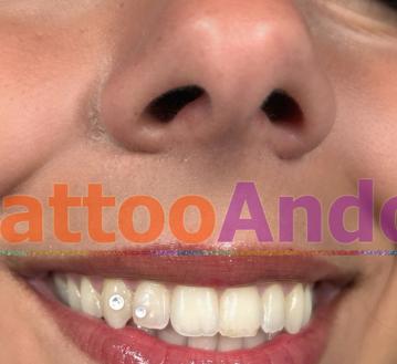 Gemas dentales festivales servicio 