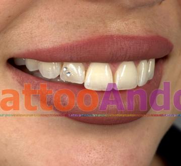 Eventos originales set joyas dentales 